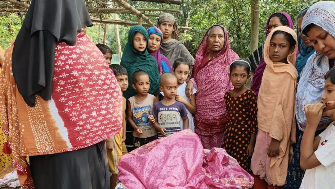 চুয়াডাঙ্গায় হামে আক্রান্ত হয়ে প্রথম শিশুর মৃত্যু, হাসপাতালে ভর্তি আরও ৫